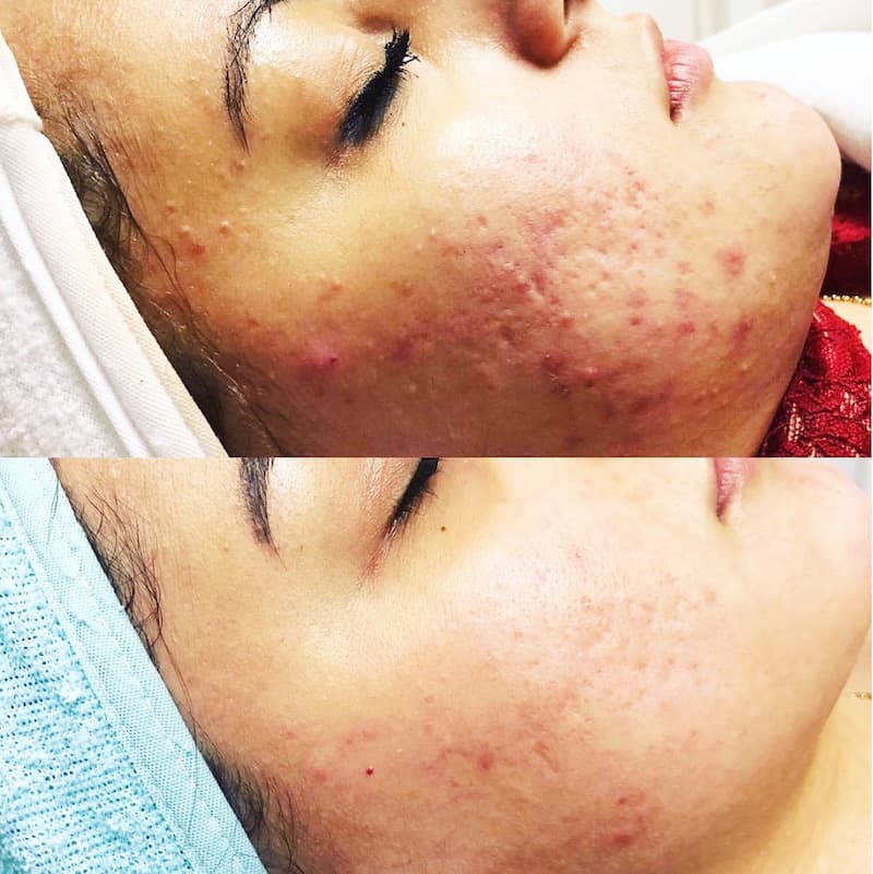 remedy spa